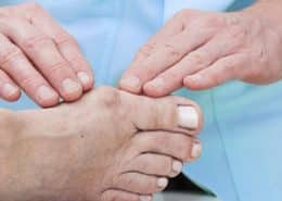 bunion