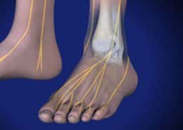 chronic ankle pain