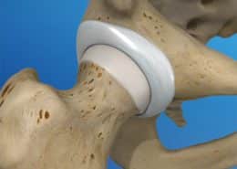 hip joint