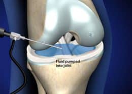 Fluid pumped into join