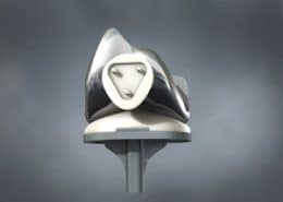 total knee replacement